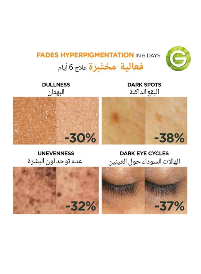 skin active fast bright hyperpigmentation and dark circles ampoule serum 1 4 1.jpg